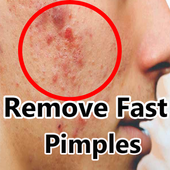 How to Get Rid of Pimples Fast icon