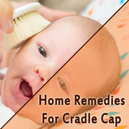 Home Remedies For Cradle Cap icon