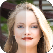 Face Blemishes Removal Photo Editor icon
