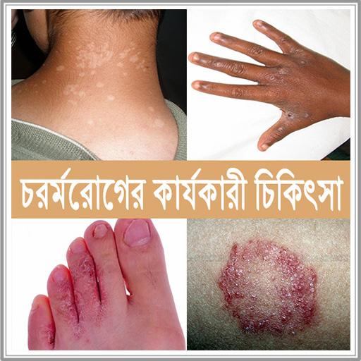 চর্ম রোগের কারণ  ও  কার্যকারী চিকিৎসা [ ছবি সহ ] icon