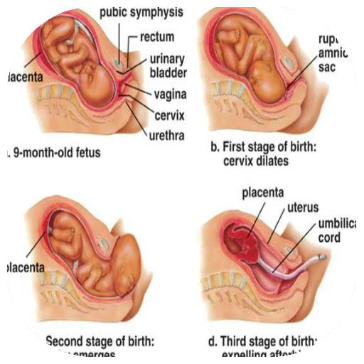 labor and delivery