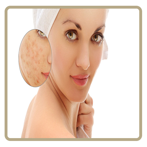 Acne &amp; Pimples (Home Care) icon