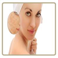 Acne & Pimples (Home Care)