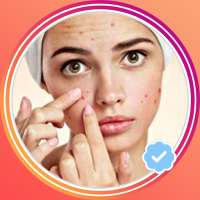 Acne Removal Video on 9Apps