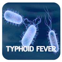 Typhoid Fever Disease