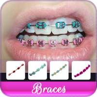 Braces Colors Beauty on 9Apps