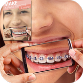 Brace Photo Editor icon