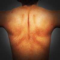 Scratch My Itchy Back