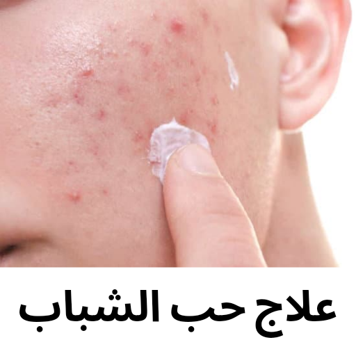 حب الشباب وعلاجه أيقونة