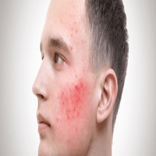 علاج البشرة وحب الشباب أيقونة