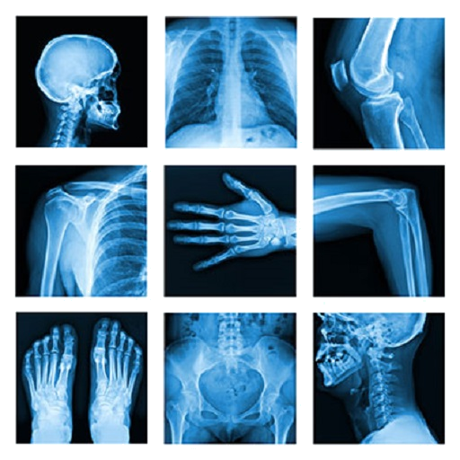 Medical X-Ray Interpretation with 100  Cases icon