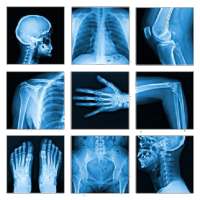 Medical X-Ray Interpretation with 100  Cases