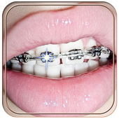 Braces icon