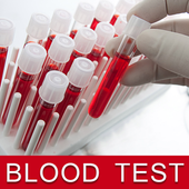 ikon Blood Test Results Free