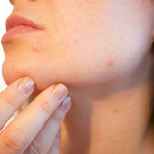 Como Eliminar Los Granos icon