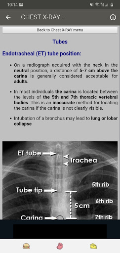 Medical X-RAY Interpretations with over 120  cases screenshot 7