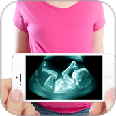 Ultrasound X-ray Scanner Prank icon