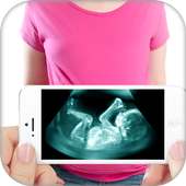 Ultrasound X-ray Scanner Prank on 9Apps