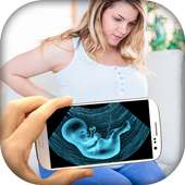 Ultrasound X-ray Scanner Prank on 9Apps