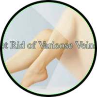 varicose veins guide on 9Apps