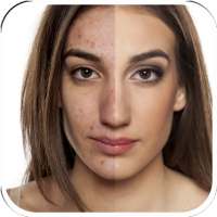 Pimple Eraser Photo Editor