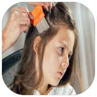 العلاج الطبيعي للقمل on 9Apps