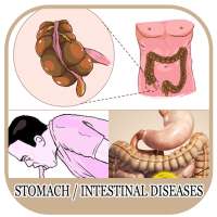 All Stomach Diseases and Treatment