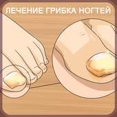 Грибок ногтей - лечение и профилактика on 9Apps