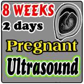 8 Weeks 2 Days Pregnant Ultrasound Guide on 9Apps