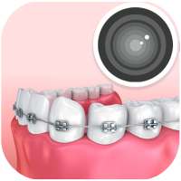 Braces photo editor & braces filter on 9Apps