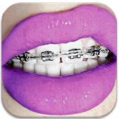 Braces- HD Camera Braces Booth icon