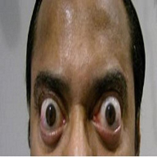 Pathognomonic Sign icon