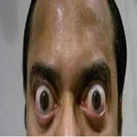 Pathognomonic Sign on 9Apps