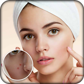 Pimple Remover : Beauty Plus icon