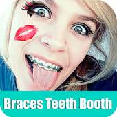 Braces Booth