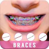 Braces Camera Beauty Selfie on 9Apps