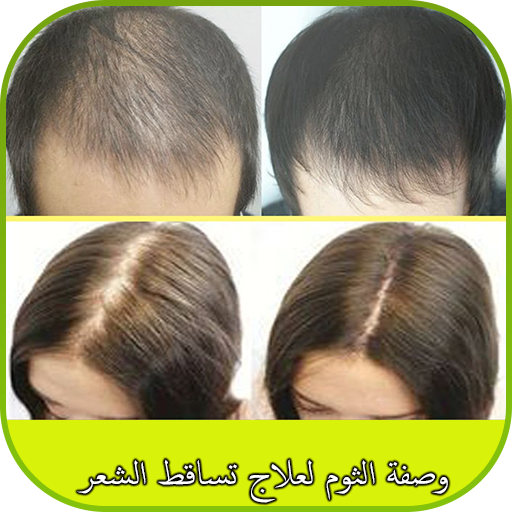 وصفة الثوم لعلاج تساقط الشعر أيقونة