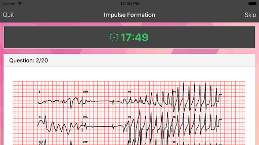 ECG Master: Quiz & Practice screenshot 2