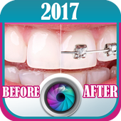 Dental Braces Before And After icon