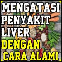 Mengatasi Penyakit Liver Dengan Cara Alami on 9Apps