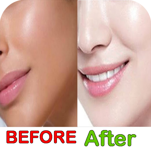 تفتيح البشرة بسرعة icon