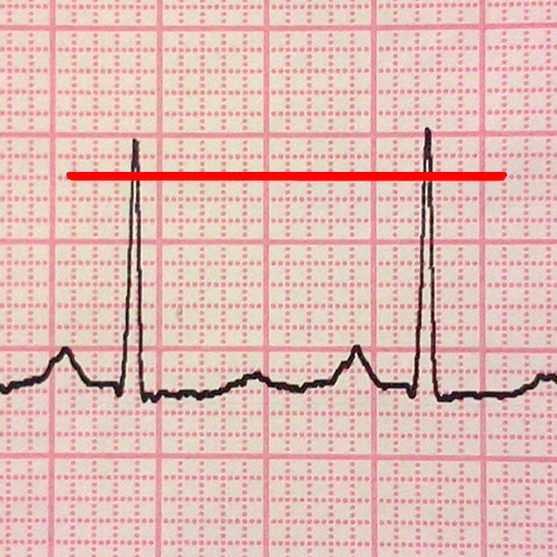 ECG Reader free icon
