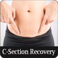 C-Section Recovery