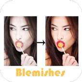 Photo Edit Blemishes on 9Apps