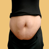 حرق الدهون لتخفيف الوزن أيقونة