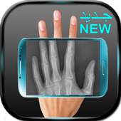 كاشف العظام و المفاصل prank on 9Apps