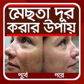 মেছতা দূর করার উপায় - mechta dur korar upay