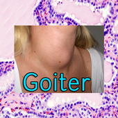 Goiter icon