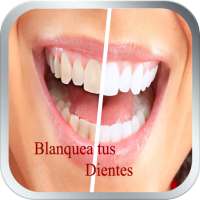 Blanquea tus Dientes en Casa