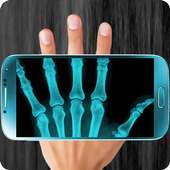 X-Ray Full Body Prank on 9Apps